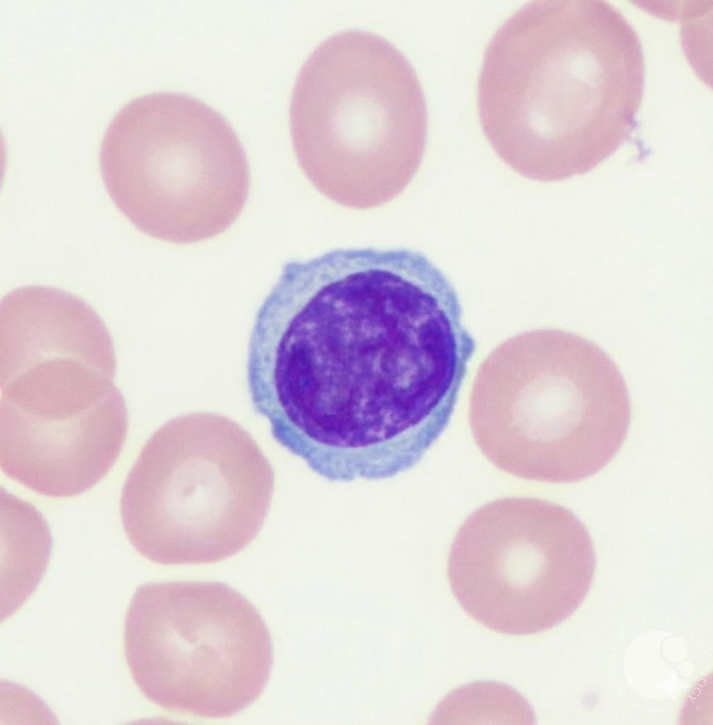 lymphocyte